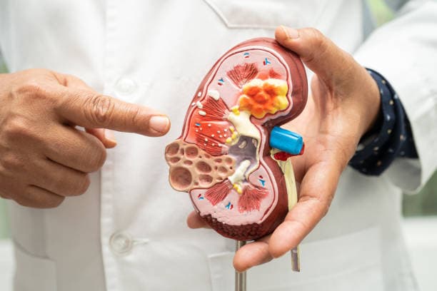 Nephrology