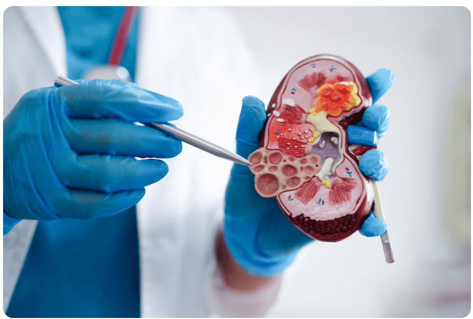 Kidney Care Unit